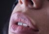 “아무리 바르고 발라도 입술이 갈라져요”… 만성 입술건조, 영양 결핍 신호일 수 있습니다 person with red lipstick and black mascara