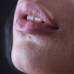 “아무리 바르고 발라도 입술이 갈라져요”… 만성 입술건조, 영양 결핍 신호일 수 있습니다 person with red lipstick and black mascara